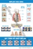 tranh tư vấn nha khoa implant nha khoa
