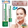 BEOTUA 20G- KEM HỖ TRỢ GIẢM MỤN KIỂM SOÁT DẦU THU NHỎ LỖ CHÂN LÔNG DƯỠNG ẨM LÀM TRẮNG DA HIỆU QUẢ
