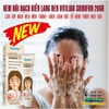 KEM BÔI BẠCH BIẾN LANG BEN VITILIGO SUMIFUN-20GR LÀM MỜ BẠCH BIẾN ĐỐM TRẮNG NÁM THÂM HIỆU QUẢ