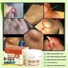 HŨ KEM THẢO MỘC LOẠI BỎ ĐÁNH TAN U MỠ BƯỚU CỔ NANYANG LIPOMA 30GR