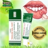 KEM THOA TRỊ NHIỆT MIỆNG TRINOLONE ORAL PASTE NIDA NHẬP KHẨU THÁI LAN