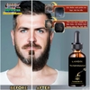 LAVDÍK HAIR GROWTH SERUM KÍCH MỌC RÂU TÓC ĐEN DÀY, BÓNG KHỎE, GIẢM GÃY RỤNG