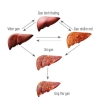 CÁC BỆNH THƯỜNG GẶP Ở GAN