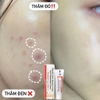 Kem dưỡng trị nám, da thâm sạm Glenmark Glycolic Acid, Arbutin & Kojic Acid Dipalmitate Cream Demelan