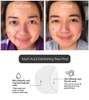 Toner Pad tẩy tế bào chết PA19 Skin Multi Acid Exfoliating Pell Pad hộp 100miếng