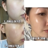 Xịt Khoáng Tế Bào Gốc Làm Dịu Phục Hồi Siêu Căng Bóng Sante - Azulene Soother Mist