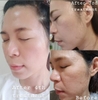 Vi tảo thay da sinh học mờ nám, mụn, lỗ chân lông to Ronas Resting Peel