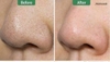 Thanh lăn trị mụn đầu đen Mamonde Pore Clean Blackhead Stick.