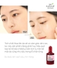 Thay da sinh học Red Peel 10ml