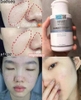 Lotion Trị Mụn Obagi Pore Therapy BHA 2% Salicylic Acid 148ml