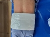 Sáp paraffin trị đau hiệu quả
