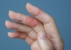 THAY ĐỔI NHỮNG THÓI QUEN NÀY ĐỂ CÓ LÀN DA TAY MỊN MÀNG TRẺ TRUNG