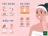 SỞ HỮU LÀN DA DẦU, BẠN CẦN PHẢI LÀM GÌ ?