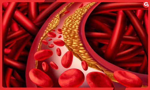 Chất béo trung tính là gì? Những điều bạn cần biết