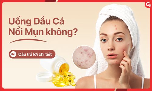 Uống dầu cá bị nổi mụn không? Sử dụng dầu cá đúng cách