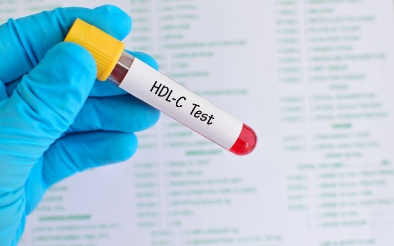 Xét nghiệm HDL