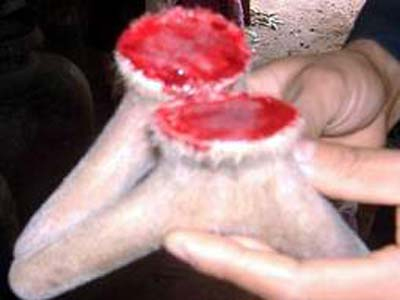 Mang bệnh vì dùng nhung hươu không đúng cách