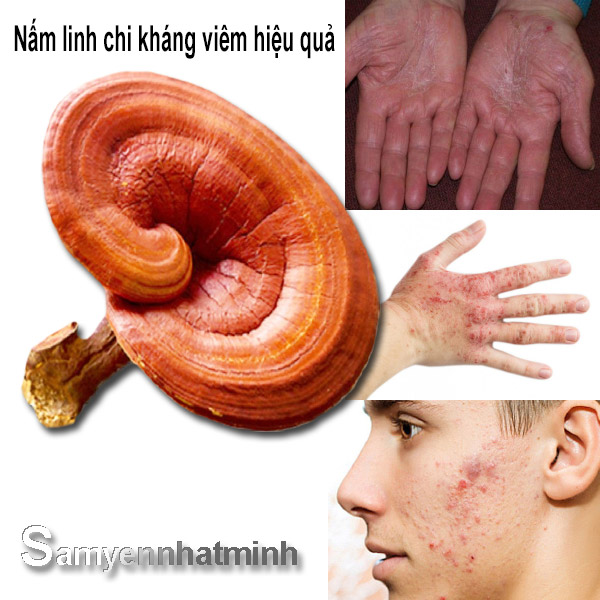 NẤM LINH CHI KHÁNG VIÊM HIỆU QUẢ