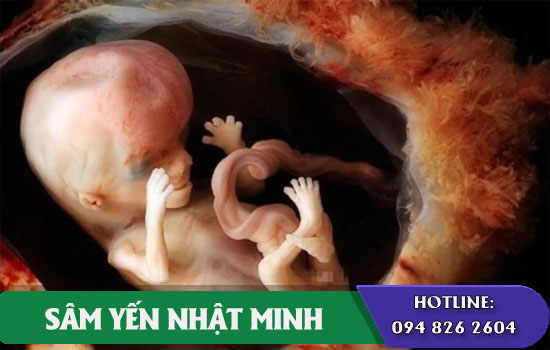 mẹ bầu uống sâm có thể gây dị tật