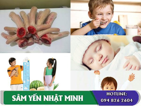 Tác dụng của nhung hươu với trẻ em