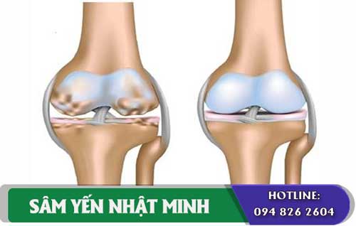 cách dùng Viên bổ xương khớp Glucosamin Hàn Quốc