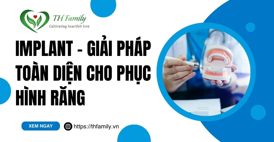 Implant - Giải Pháp Toàn Diện Cho Phục Hình Răng
