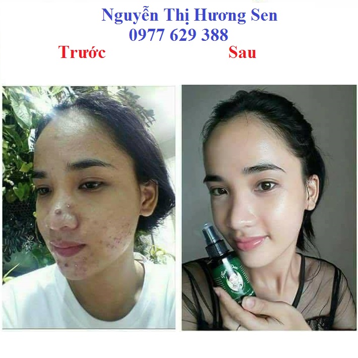 Mỹ phẩm thanh dược điều trị mụn tái tạo da Thanh Dược – FullShop.vn