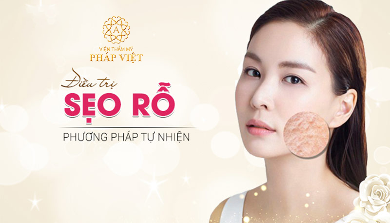 Trị sẹo rỗ lâu năm bằng phương pháp nào tốt nhất?