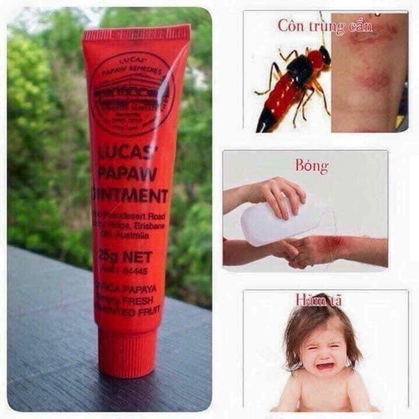 Bé bị côn trùng cắn sưng tấy: Mẹ cần phải làm gì