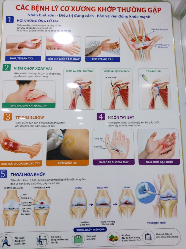 Poster bệnh lý cơ xương khớp thường gặp tại bệnh viện