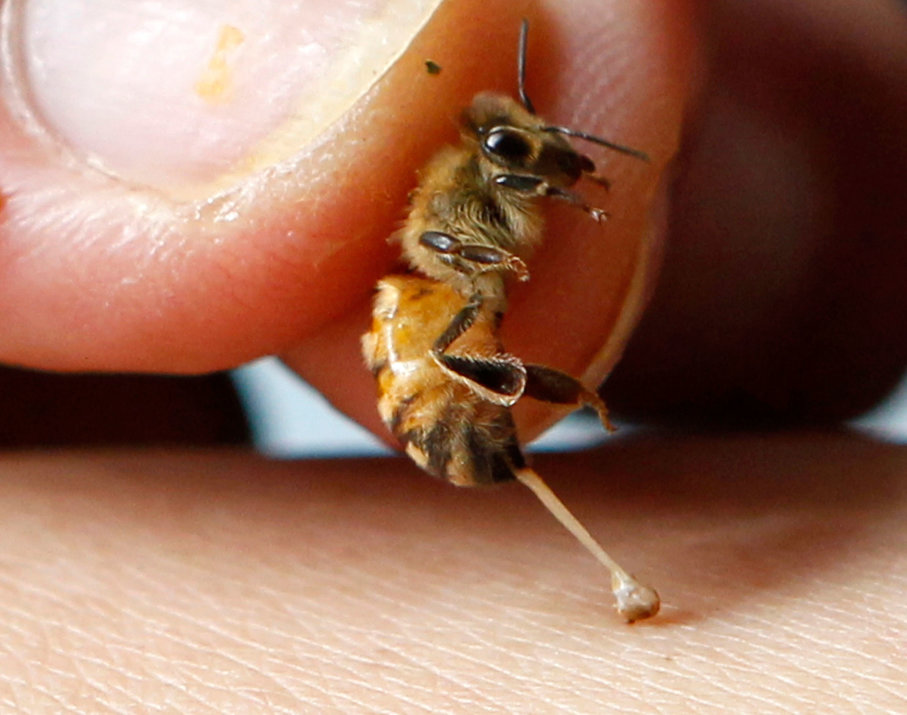 Hiệu quả bất ngờ từ trị viêm khớp bằng nọc ong