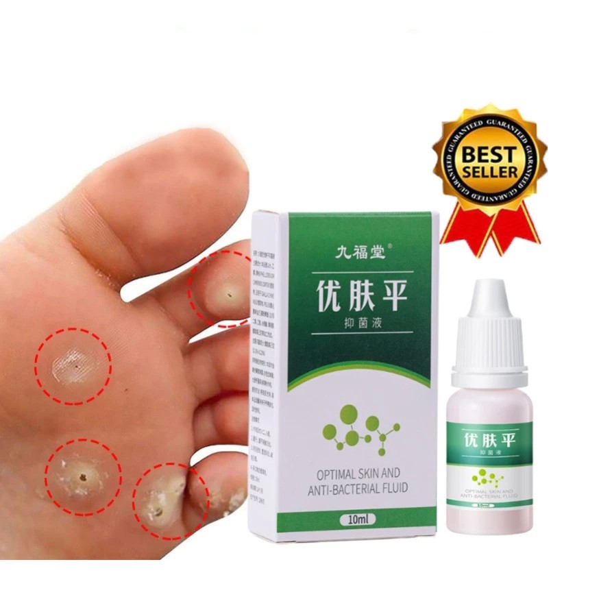 Thuốc Tẩy Mụn Cóc kem tẩy nốt ruồi mụn cóc