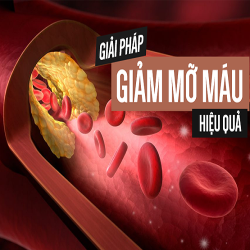 phan-4-tu-yeu-truong-canh-nhac-tri-dam
