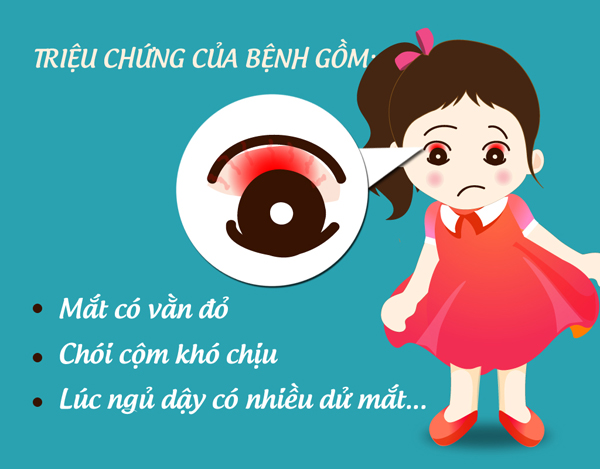 ĐAU MẮT ĐỎ LÀ GÌ? NGUYÊN NHÂN ĐAU MẮT ĐỎ? GIẢI PHÁP CHO ĐAU MẮT ĐỎ