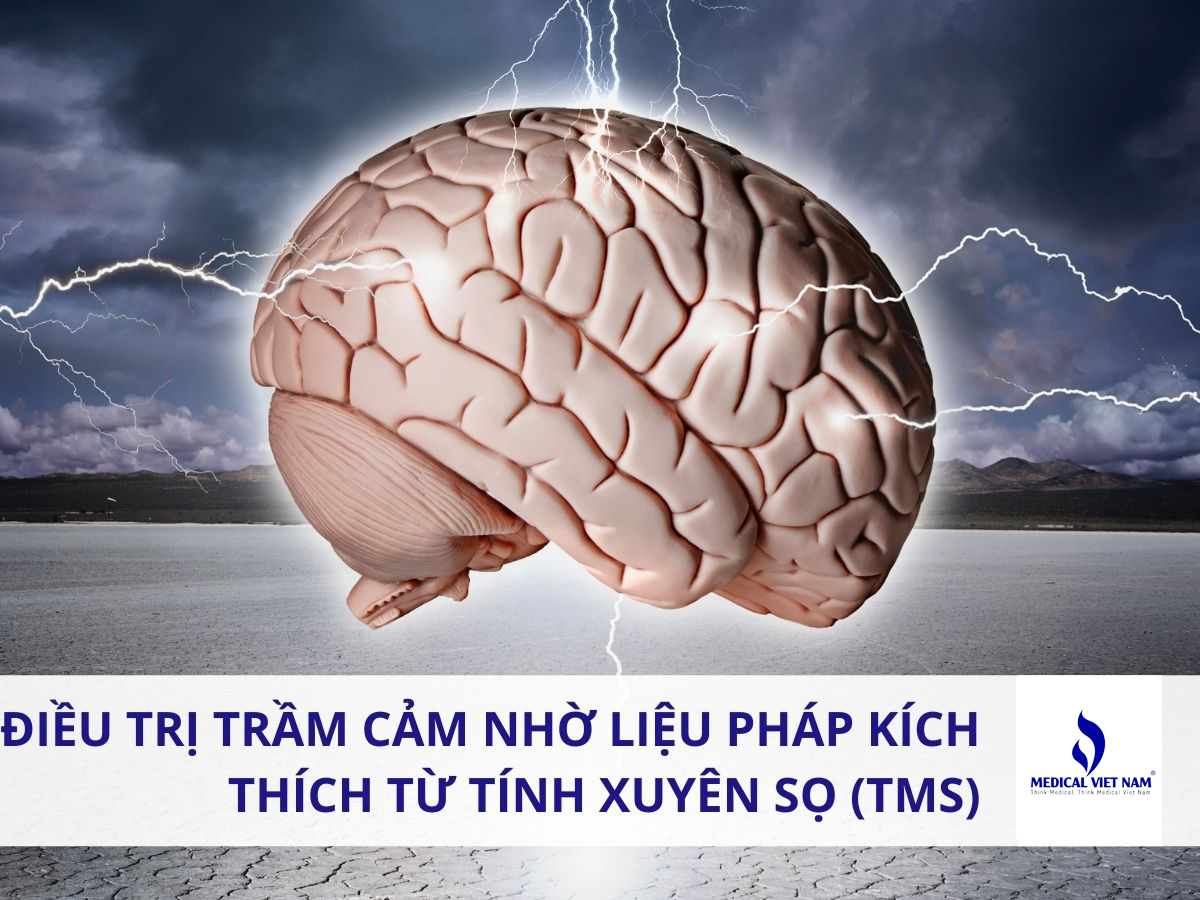 Ứng Dụng Kích Thích Từ Xuyên Sọ Chữa Trầm Cảm Có Hiệu Quả Không?