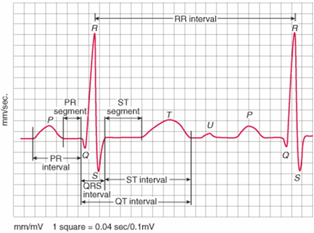 Máy điện tim - Máy điện tâm đồ (ECG) là gì