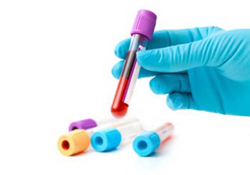Ý nghĩa và giá trị lâm sàng các chỉ số xét nghiệm sinh hóa máu