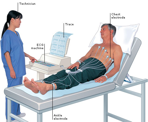 Máy điện tim - Tổng quan về máy điện tim