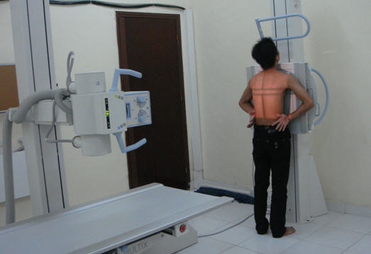 Kỹ thuật chụp X quang tim - phổi cơ bản