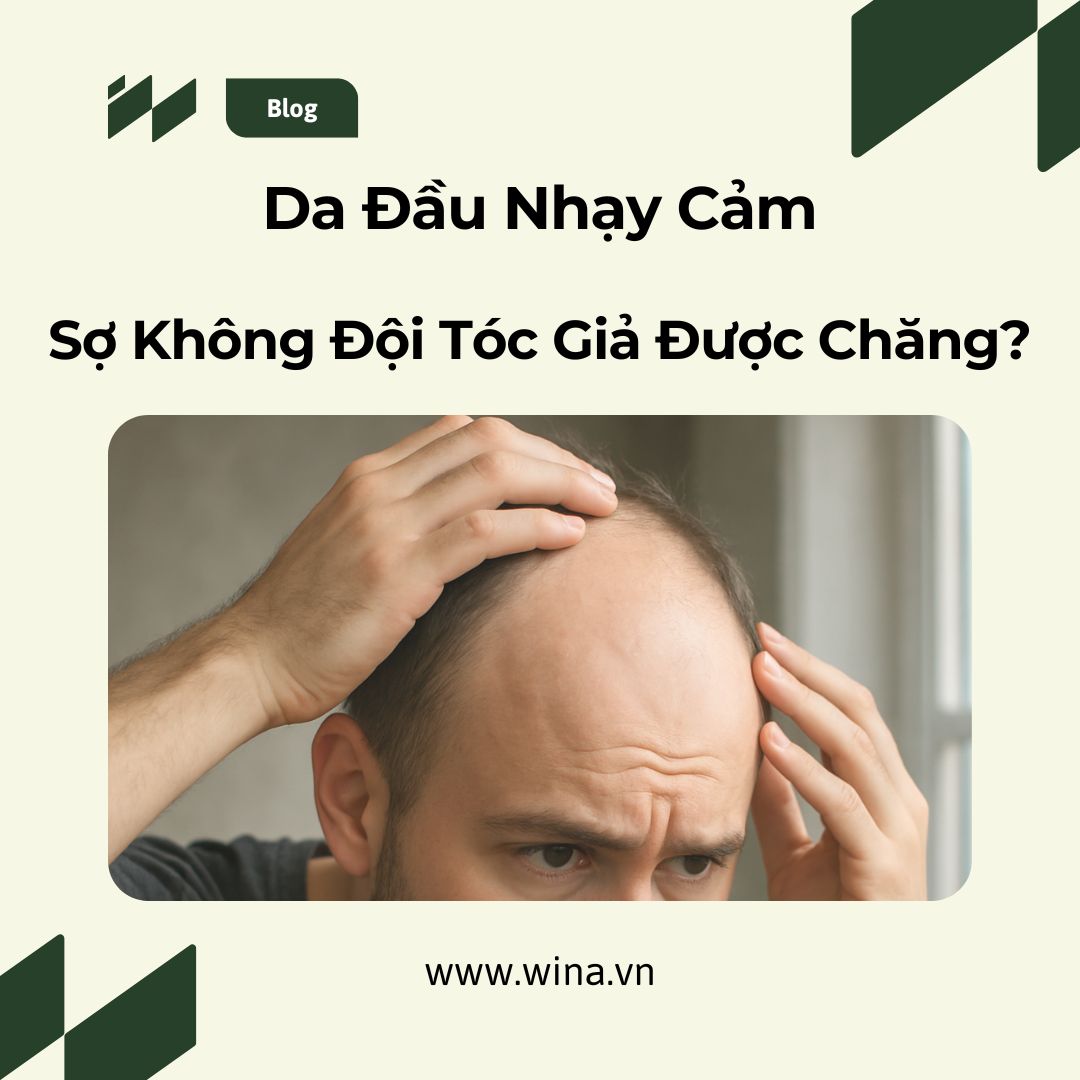 Tóc Giả Nam Cho Da Đầu Nhạy Cảm – Nên Chọn Gì?