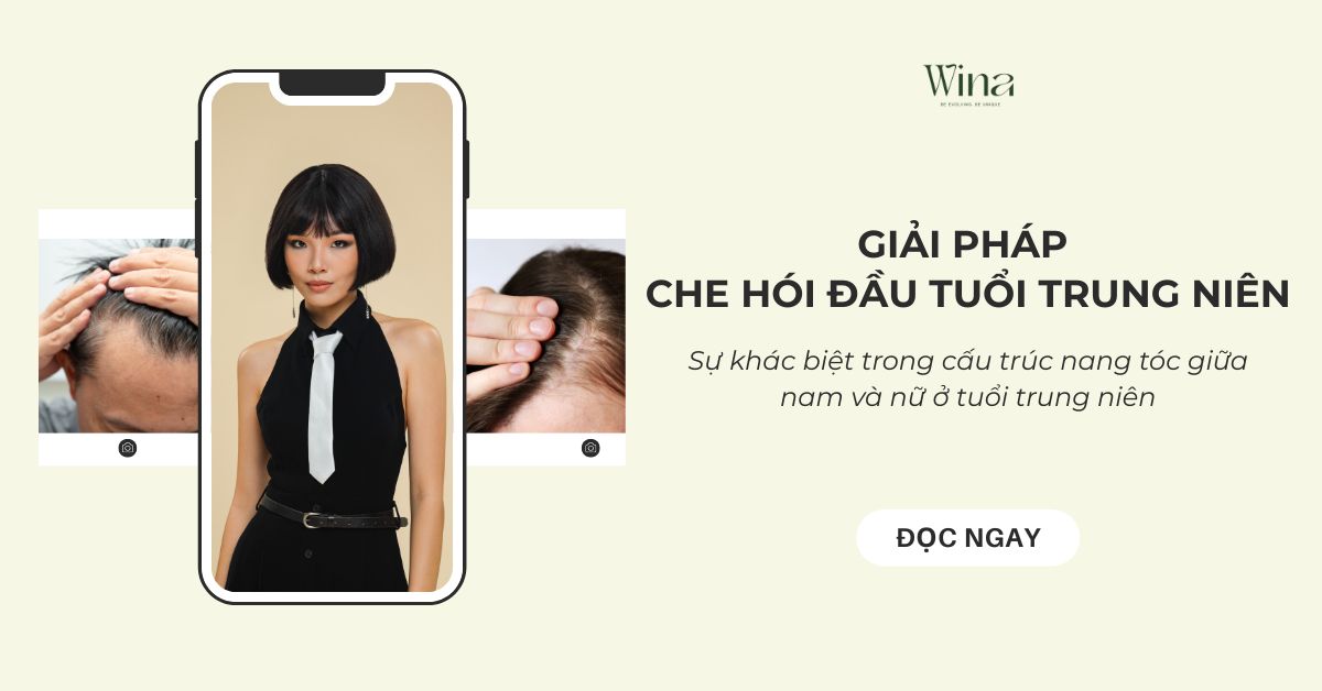 Giải Pháp Che Hói Đầu Tuổi Trung Niên: Hiểu Về Nang Tóc Để Khôi Phục Diện Mạo