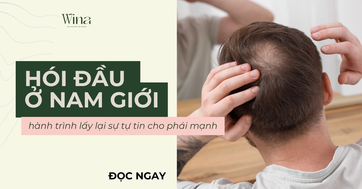 Hói Đầu Có Đáng Sợ: Hành Trình Lấy Lại Sự Tự Tin Cho Phái Mạnh