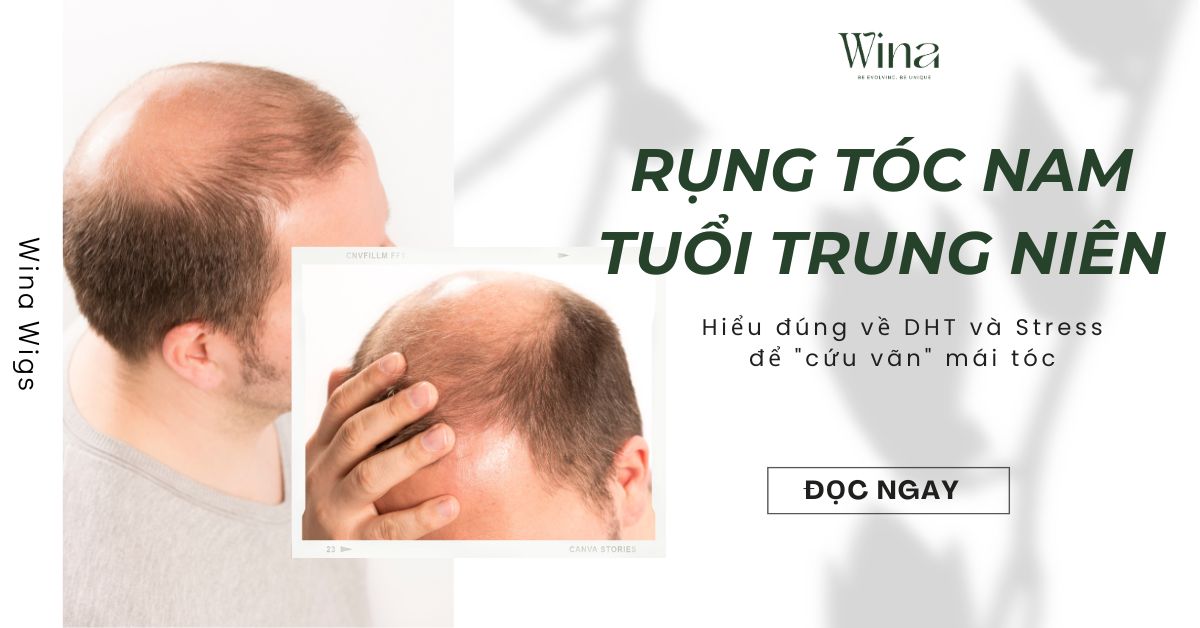 Rụng Tóc Nam Tuổi Trung Niên: Hiểu Đúng Về DHT Và Căng Thẳng Đến Mái Tóc