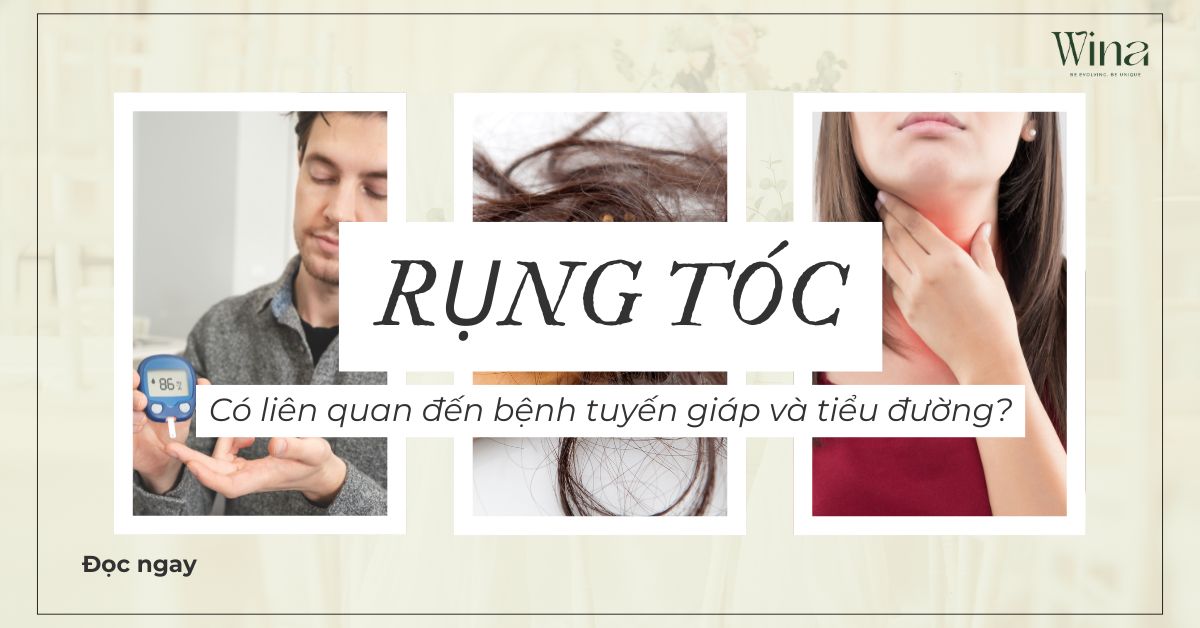 Bệnh Tuyến Giáp, Tiểu Đường Có Gây Rụng Tóc Không?