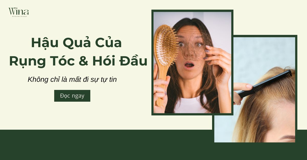 Hậu Quả Của Việc Rụng Tóc, Hói Đầu: Không Chỉ Là Mất Đi Sự Tự Tin