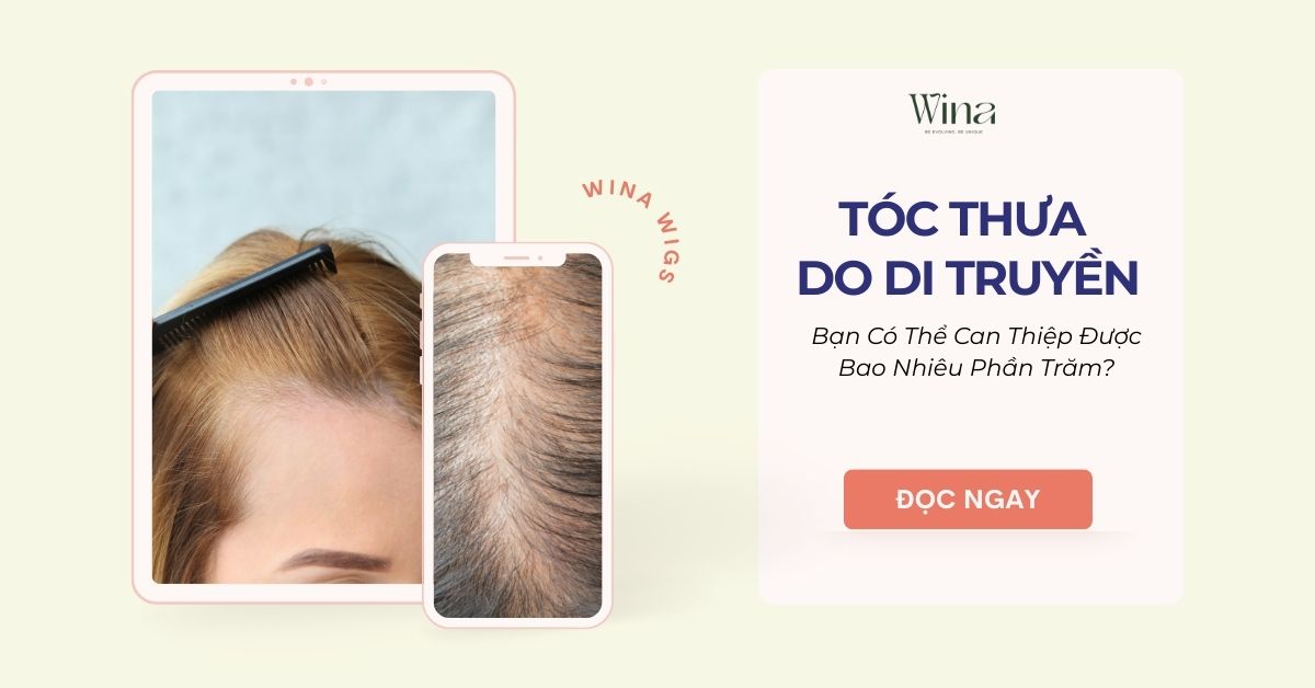 Tóc Thưa Do Di Truyền: Bạn Có Thể Can Thiệp Được Bao Nhiêu Phần Trăm?