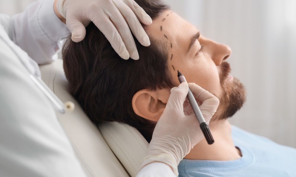 Cấy tóc tự thân là một thủ thuật ngoại khoa nhằm di chuyển những nang tóc khỏe mạnh từ vùng hiến (thường là khu vực sau gáy và hai bên mang tai) đến cấy vào vùng nhận (khu vực bị hói hoặc tóc thưa)