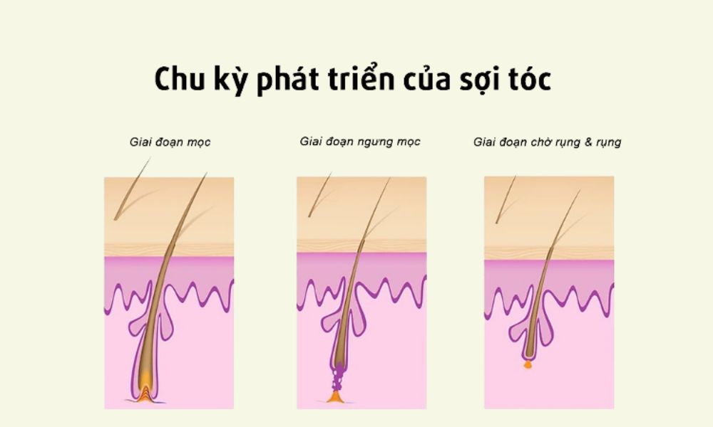 Một sợi tóc có 3 giai đoạn sống: Mọc - Ngừng phát triển - Rụng