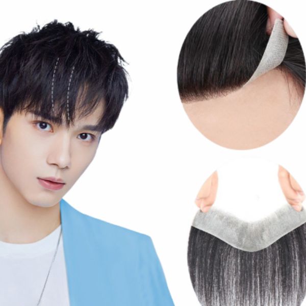 Wina Wigs mang đến dòng sản phẩm che khuyết điểm trán chữ M đáp ứng các tiêu chuẩn khắt khe về thẩm mỹ và chất lượng