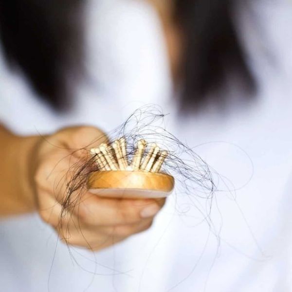 Rụng tóc nhiều ở nữ tiềm ẩn nguy cơ mắc bệnh